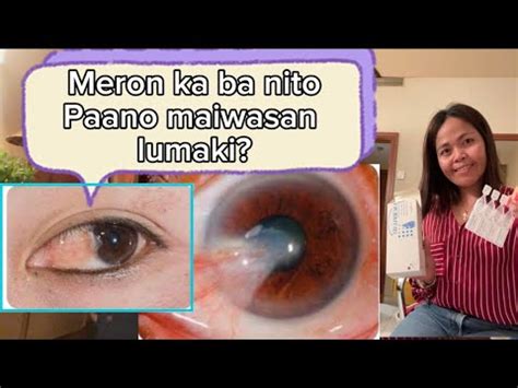 Sumailalim ako sa surgery! .